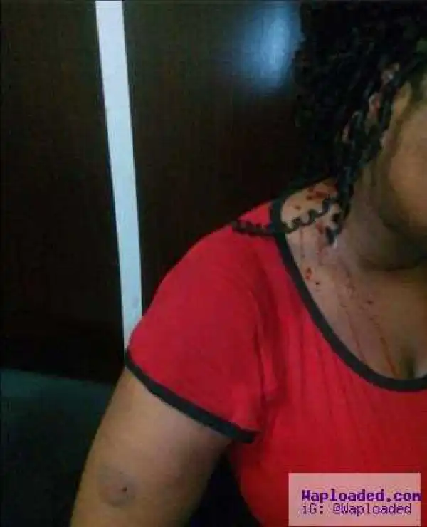 Gruesome Photo: Brutal Uniben lawyer reportedly cuts off wife